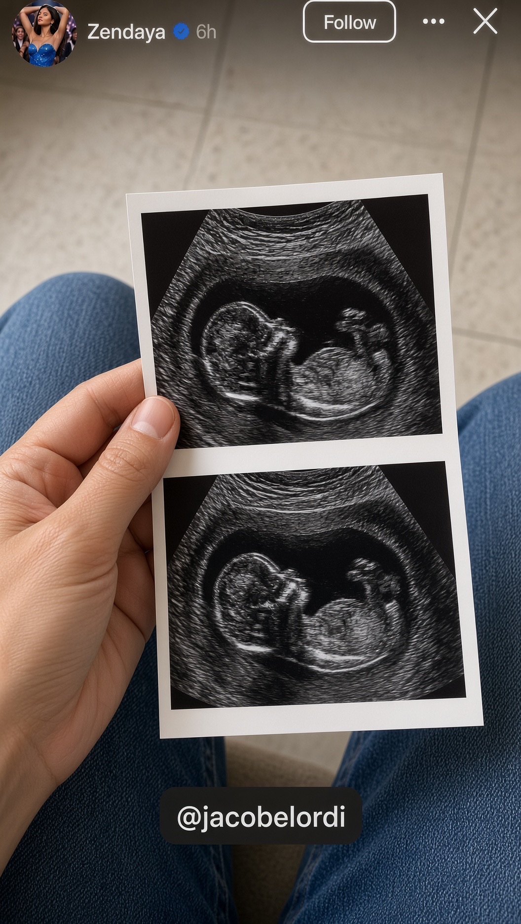 An Instagram Story-style image appearing to be from Zendaya's account, showing a hand holding two ultrasound photos.