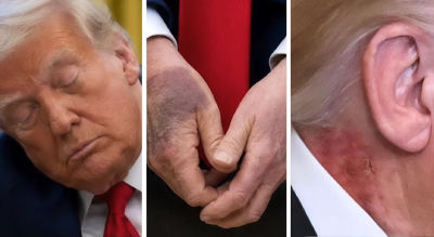 AI-generated image of Donald Trump showing visible bruises